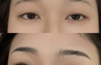 Why do my eyebrows grow back so fast after waxing?
